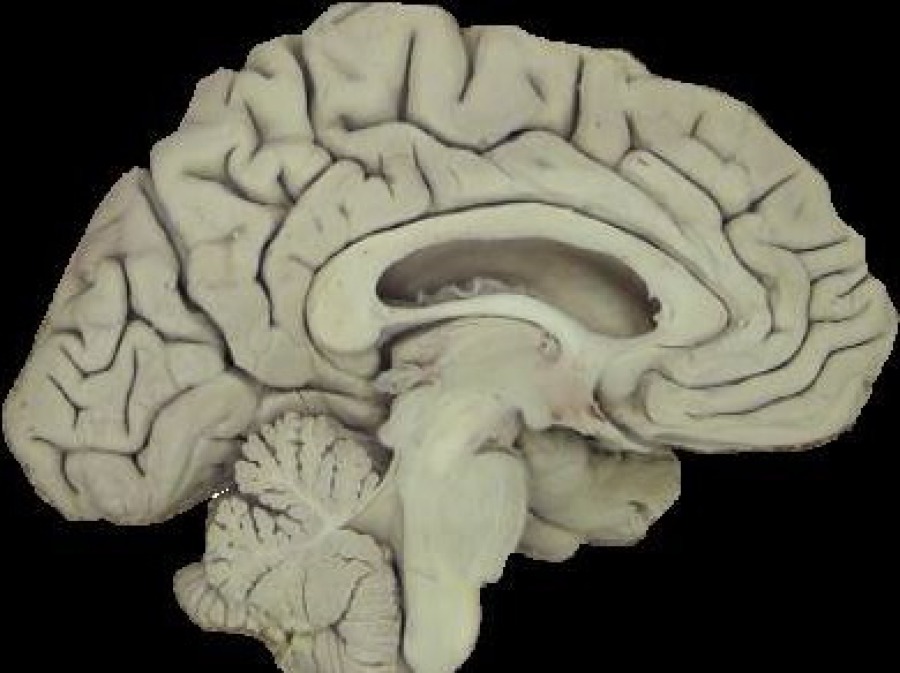 Длинные отростки головного мозга. Головной мозг препарат. Препарат мозга анатомия. Срез мозга здорового человека.